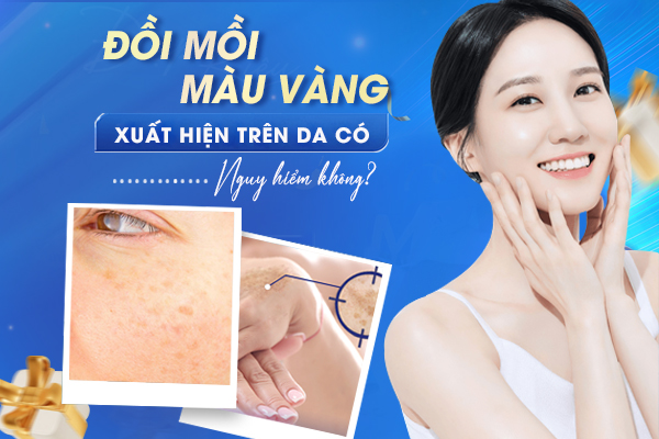 Đồi mồi màu vàng trên da có nguy hiểm không?