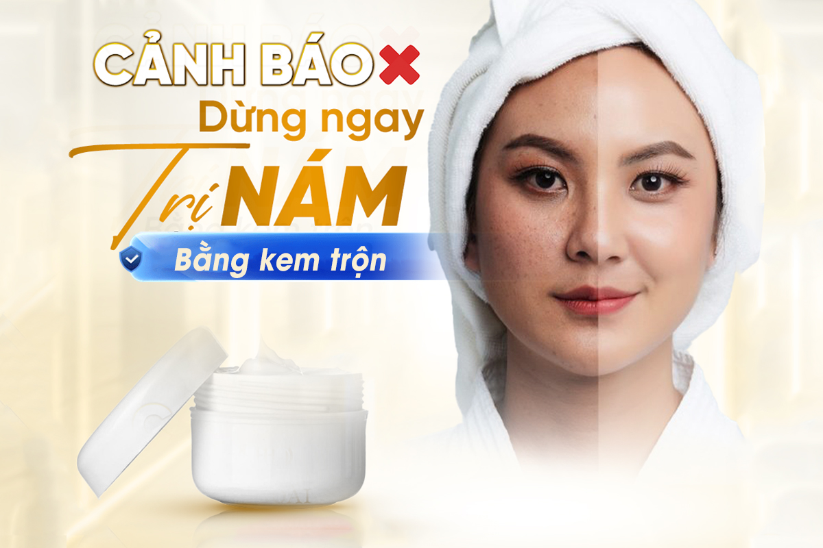 Cảnh báo Dừng ngay trị Nám bằng kem trộn và những điều cần biết