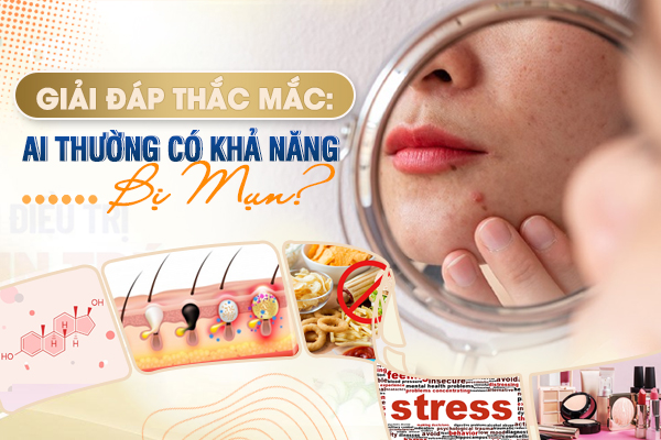 Ai thường có khả năng bị mụn?