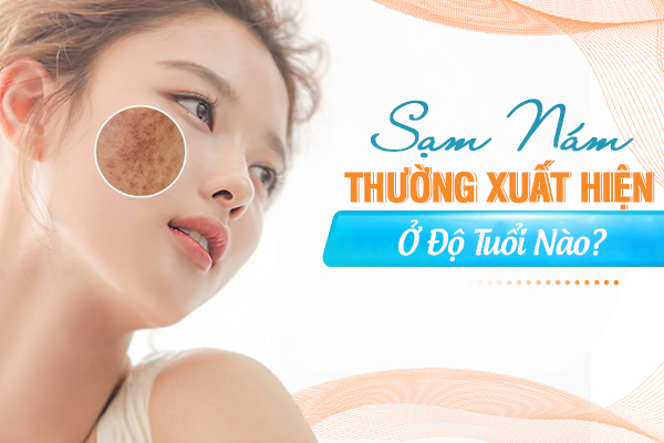 Sạm, nám thường xuất hiện ở độ tuổi nào? Cách ngăn ngừa hiệu quả