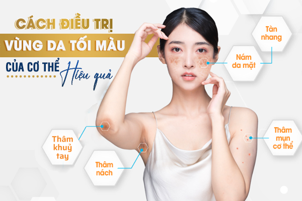 Cách điều trị các vùng da tối màu của cơ thể hiệu quả