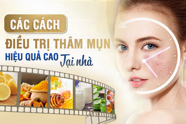 Các cách điều trị thâm hiệu quả cao tại nhà