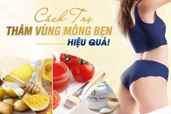 Cách trị thâm ở vùng mông, bẹn hiệu quả