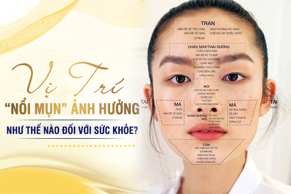 Các vị trí của mụn ảnh hưởng như thế nào đối với sức khỏe?