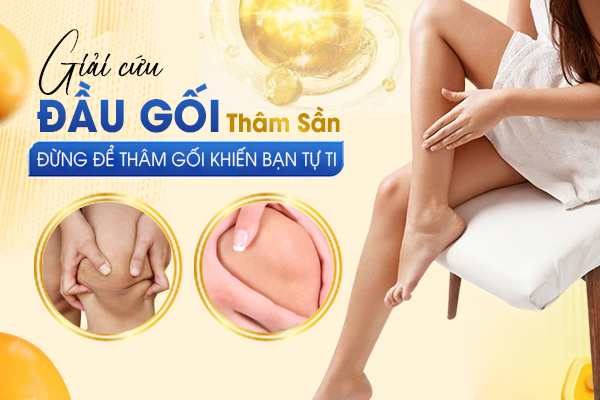 Giải Cứu Đầu Gối Thâm Sần - Đừng Để Thâm Gối Khiến Bạn Tự Ti