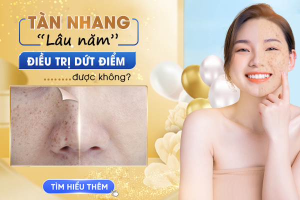 Góc giải đáp: Tàn nhang lâu năm có điều trị dứt điểm được không?