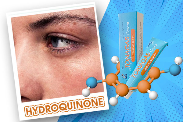 Hydroquinone Là Gì? Có Nên Sử Dụng Hydroquinone Điều Trị Nám Da, Tàn Nhang?