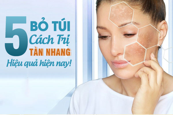 Tàn Nhang Là Gì? Bỏ Túi Ngay 5 Cách Trị Tàn Nhang Hiệu Quả Bạn Cần Biết