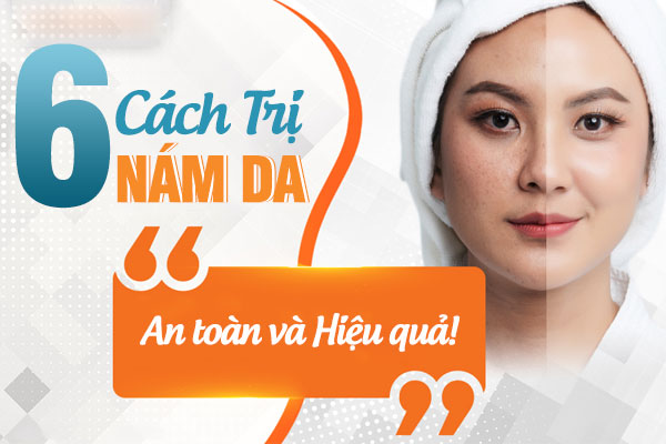 Nám Da Là Gì? 6 Cách Trị Nám An Toàn, Hiệu Quả