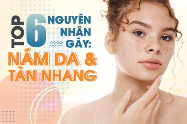 Nguyên nhân gây nám tàn nhang - Không phải ai cũng biết