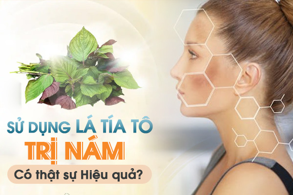 Sử dụng lá tía tô trị nám có thật sự hiệu quả?